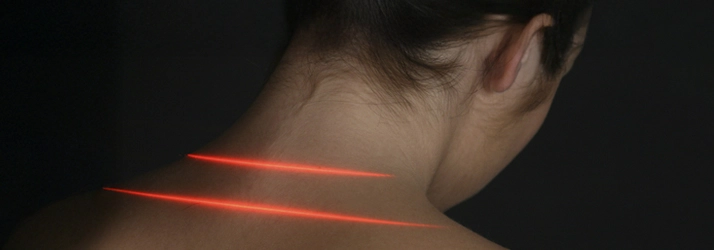 Concussion Irvine CA Cold Laser Therapy Two red laser lights on a persons neck.